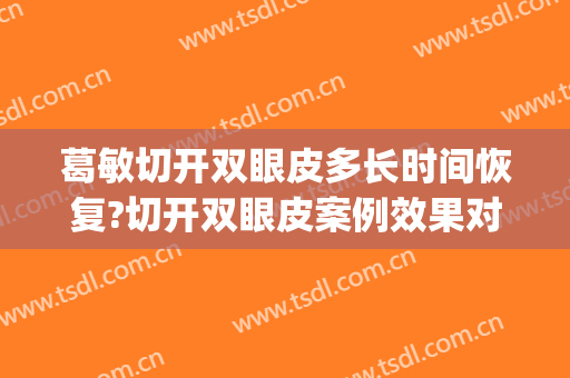 葛敏切开双眼皮多长时间恢复?切开双眼皮案例效果对比图_上海伯思立医疗美容门诊部