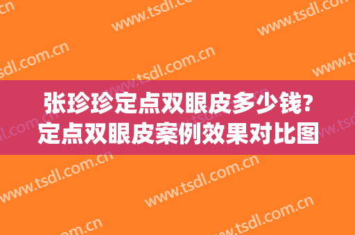 张珍珍定点双眼皮多少钱?定点双眼皮案例效果对比图_复旦大学附属眼耳鼻喉科医院