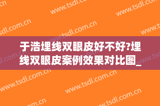于浩埋线双眼皮好不好?埋线双眼皮案例效果对比图_中国医学科学院整形外科医院