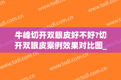 牛峰切开双眼皮好不好?切开双眼皮案例效果对比图_中国医学科学院整形外科医院