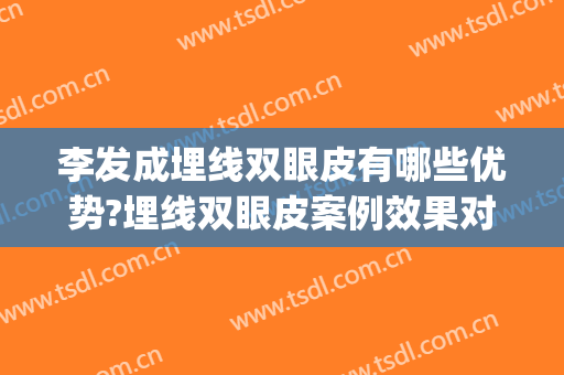 李发成埋线双眼皮有哪些优势?埋线双眼皮案例效果对比图_中国医学科学院整形外科医院