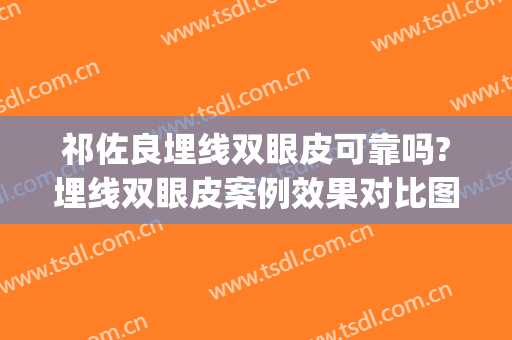 祁佐良埋线双眼皮可靠吗?埋线双眼皮案例效果对比图_中国医学科学院整形外科医院