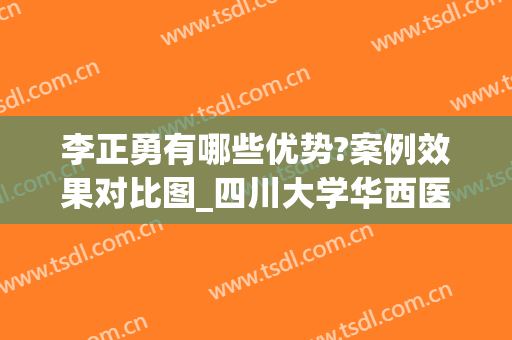 李正勇有哪些优势?案例效果对比图_四川大学华西医院