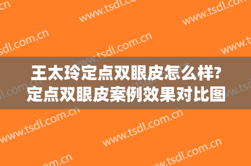 王太玲定点双眼皮怎么样?定点双眼皮案例效果对比图_中国医学科学院整形外科医院