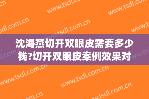 沈海燕切开双眼皮需要多少钱?切开双眼皮案例效果对比图_杭州市第一人民医院