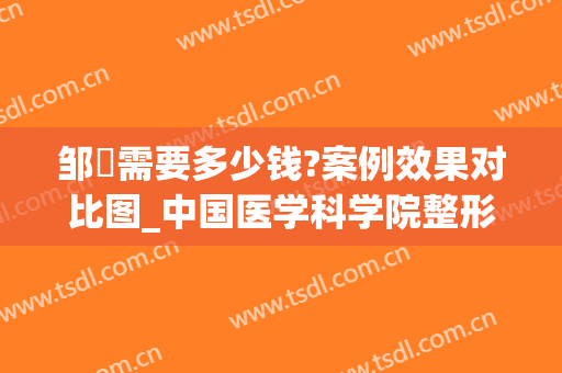邹翀需要多少钱?案例效果对比图_中国医学科学院整形外科医院