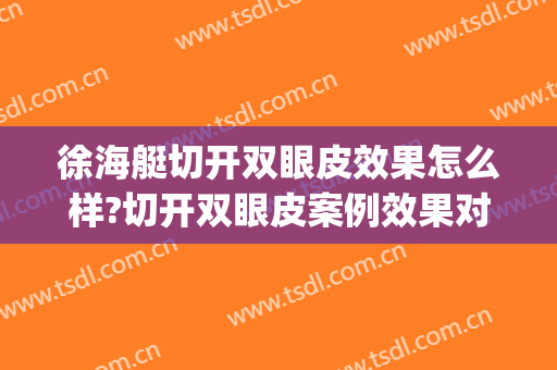 徐海艇切开双眼皮效果怎么样?切开双眼皮案例效果对比图_温州医科大学附属第二医院