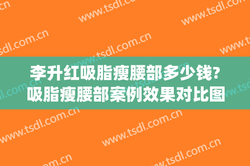 李升红吸脂瘦腰部多少钱?吸脂瘦腰部案例效果对比图_暨南大学附属第一医院