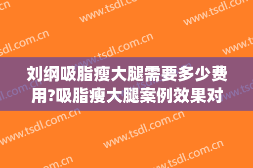 刘纲吸脂瘦大腿需要多少费用?吸脂瘦大腿案例效果对比图_好大夫工作室