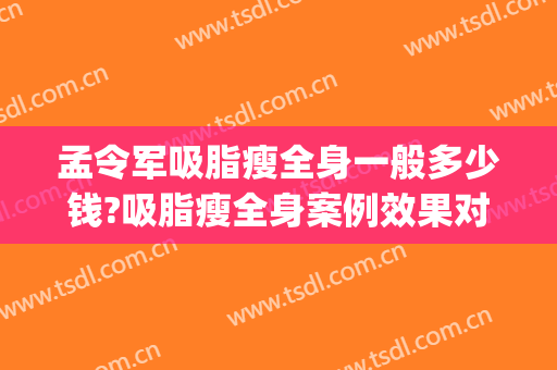 孟令军吸脂瘦全身一般多少钱?吸脂瘦全身案例效果对比图_唐山市工人医院