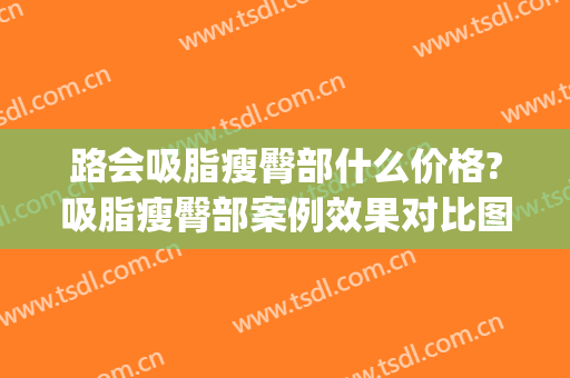 路会吸脂瘦臀部什么价格?吸脂瘦臀部案例效果对比图_中日友好医院(腿部吸脂价格多少钱)