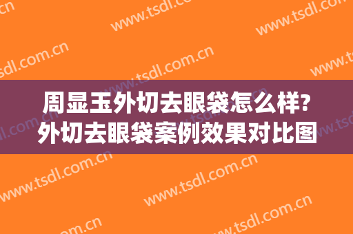 周显玉外切去眼袋怎么样?外切去眼袋案例效果对比图_上海交通大学医学院附属第九人民医院