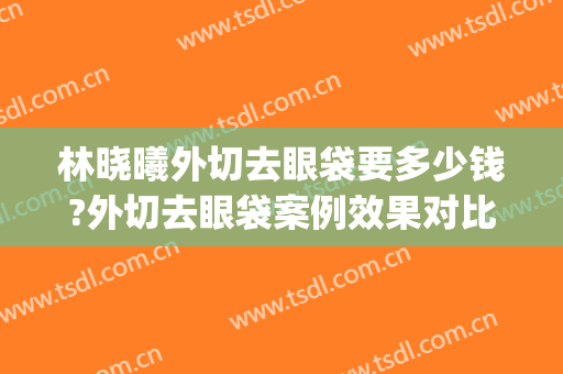林晓曦外切去眼袋要多少钱?外切去眼袋案例效果对比图_上海交通大学医学院附属第九人民医院