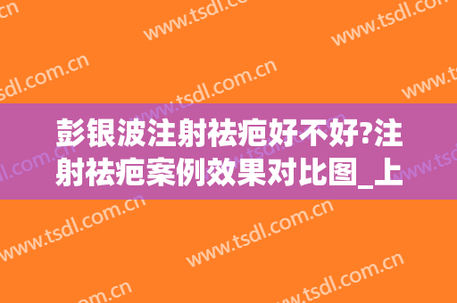 彭银波注射祛疤好不好?注射祛疤案例效果对比图_上海交通大学医学院附属第九人民医院北部院区