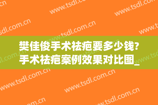樊佳俊手术祛疤要多少钱?手术祛疤案例效果对比图_上海交通大学医学院附属第九人民医院