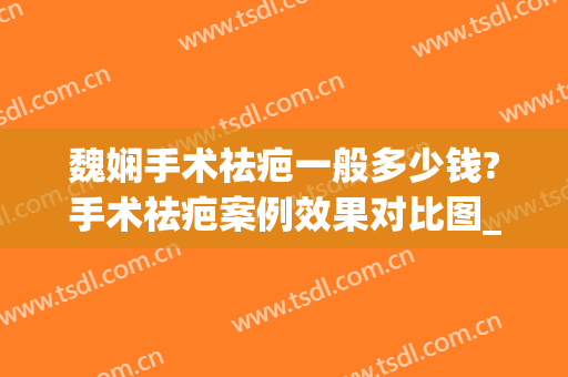 魏娴手术祛疤一般多少钱?手术祛疤案例效果对比图_上海交通大学医学院附属第九人民医院