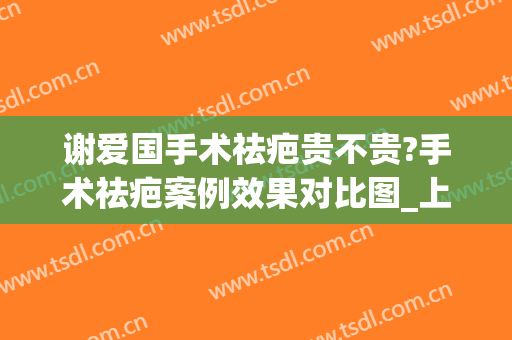 谢爱国手术祛疤贵不贵?手术祛疤案例效果对比图_上海交通大学医学院附属第九人民医院