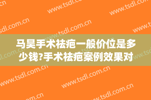 马昊手术祛疤一般价位是多少钱?手术祛疤案例效果对比图_上海交通大学医学院附属第九人民医院