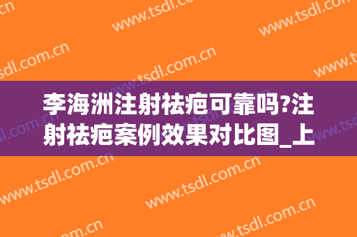 李海洲注射祛疤可靠吗?注射祛疤案例效果对比图_上海交通大学医学院附属第九人民医院