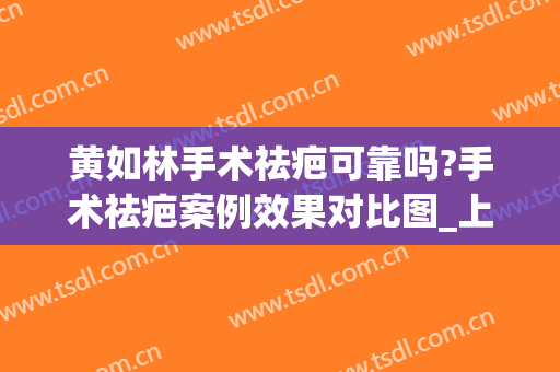 黄如林手术祛疤可靠吗?手术祛疤案例效果对比图_上海交通大学医学院附属第九人民医院
