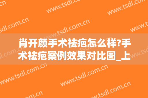 肖开颜手术祛疤怎么样?手术祛疤案例效果对比图_上海交通大学医学院附属第九人民医院