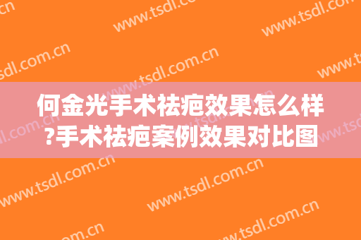 何金光手术祛疤效果怎么样?手术祛疤案例效果对比图_上海交通大学医学院附属第九人民医院