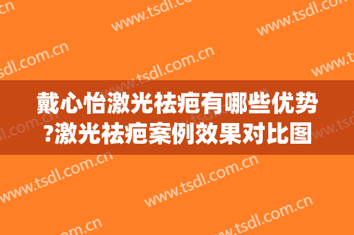 戴心怡激光祛疤有哪些优势?激光祛疤案例效果对比图_上海交通大学医学院附属第九人民医院