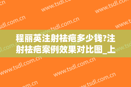 程丽英注射祛疤多少钱?注射祛疤案例效果对比图_上海交通大学医学院附属第九人民医院