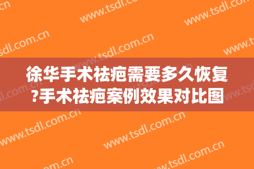 徐华手术祛疤需要多久恢复?手术祛疤案例效果对比图_上海交通大学医学院附属第九人民医院