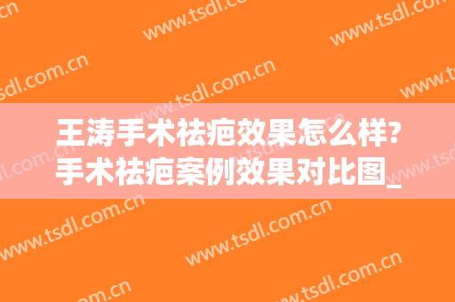 王涛手术祛疤效果怎么样?手术祛疤案例效果对比图_上海交通大学医学院附属第九人民医院