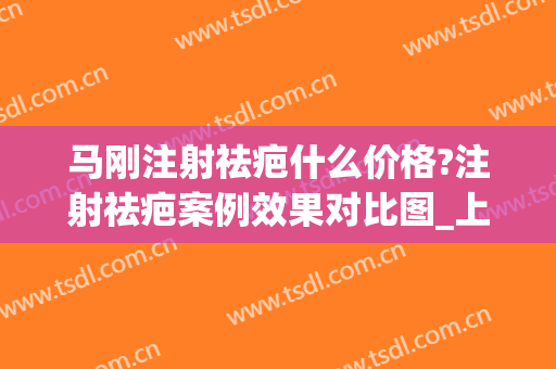 马刚注射祛疤什么价格?注射祛疤案例效果对比图_上海交通大学医学院附属第九人民医院