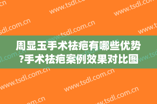 周显玉手术祛疤有哪些优势?手术祛疤案例效果对比图_上海交通大学医学院附属第九人民医院