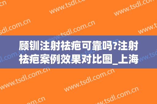 顾钏注射祛疤可靠吗?注射祛疤案例效果对比图_上海交通大学医学院附属第九人民医院北部院区