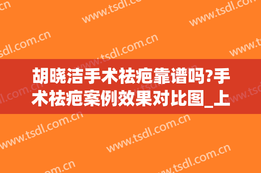 胡晓洁手术祛疤靠谱吗?手术祛疤案例效果对比图_上海交通大学医学院附属第九人民医院