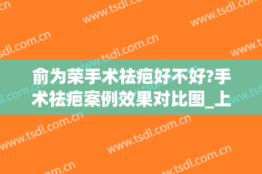 俞为荣手术祛疤好不好?手术祛疤案例效果对比图_上海交通大学医学院附属第九人民医院北部院区