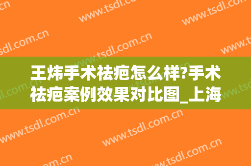王炜手术祛疤怎么样?手术祛疤案例效果对比图_上海交通大学医学院附属第九人民医院