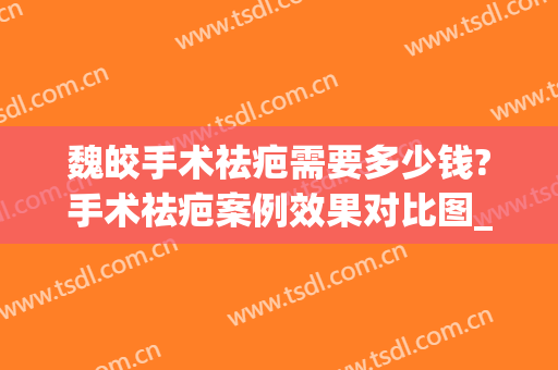 魏皎手术祛疤需要多少钱?手术祛疤案例效果对比图_上海交通大学医学院附属第九人民医院