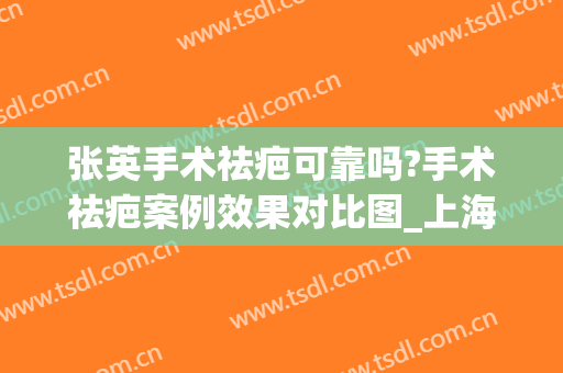 张英手术祛疤可靠吗?手术祛疤案例效果对比图_上海交通大学医学院附属第九人民医院