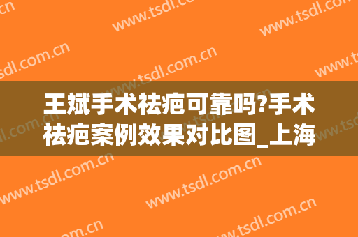 王斌手术祛疤可靠吗?手术祛疤案例效果对比图_上海交通大学医学院附属第九人民医院
