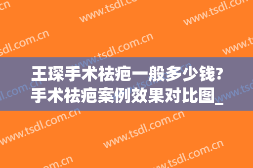 王琛手术祛疤一般多少钱?手术祛疤案例效果对比图_上海交通大学医学院附属第九人民医院