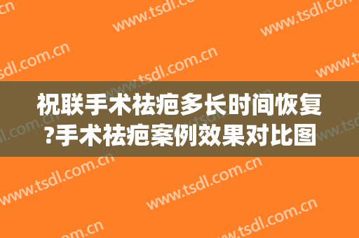 祝联手术祛疤多长时间恢复?手术祛疤案例效果对比图_上海交通大学医学院附属第九人民医院