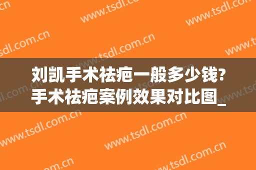 刘凯手术祛疤一般多少钱?手术祛疤案例效果对比图_上海交通大学医学院附属第九人民医院