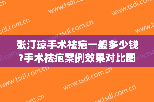 张汀琼手术祛疤一般多少钱?手术祛疤案例效果对比图_上海交通大学医学院附属第九人民医院
