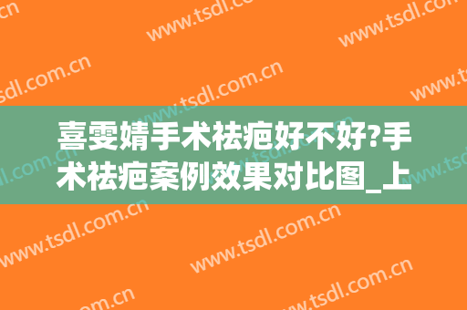 喜雯婧手术祛疤好不好?手术祛疤案例效果对比图_上海交通大学医学院附属第九人民医院