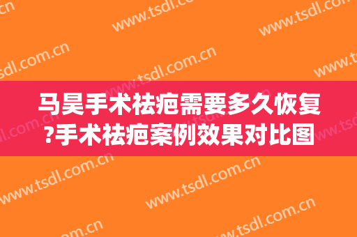 马昊手术祛疤需要多久恢复?手术祛疤案例效果对比图_上海交通大学医学院附属第九人民医院
