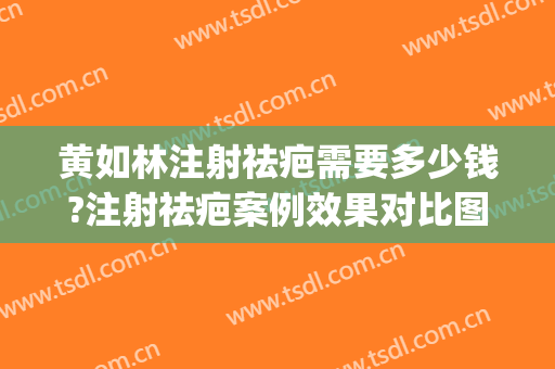 黄如林注射祛疤需要多少钱?注射祛疤案例效果对比图_上海交通大学医学院附属第九人民医院
