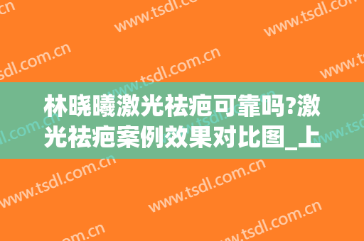 林晓曦激光祛疤可靠吗?激光祛疤案例效果对比图_上海交通大学医学院附属第九人民医院