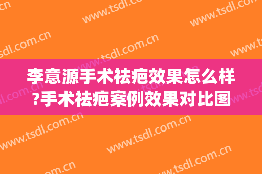 李意源手术祛疤效果怎么样?手术祛疤案例效果对比图_上海交通大学医学院附属第九人民医院