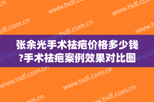 张余光手术祛疤价格多少钱?手术祛疤案例效果对比图_上海交通大学医学院附属第九人民医院