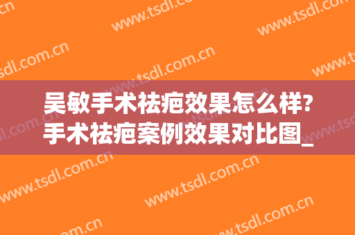 吴敏手术祛疤效果怎么样?手术祛疤案例效果对比图_上海交通大学医学院附属第九人民医院